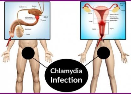 benh-chlamydia-day-la-tat-ca-nhung-dieu-ban-can-biet