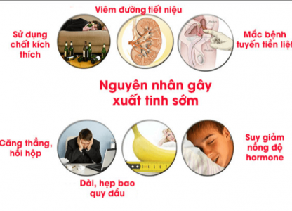 10-cau-hoi-quan-trong-nhat-lien-quan-den-dai-bao-quy-dau