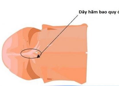 xu-ly-dut-day-ham-bao-quy-dau-nhu-the-nao