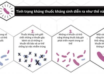 viem-mao-tinh-hoan-co-gay-vo-sinh-khong-nhan-biet-giai-doan-benh-va-cach-chua-benh-tot-nhat