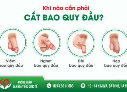 vi-sao-can-cat-bao-quy-dau