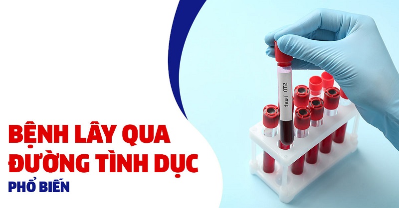 Bệnh lây qua đường tình dục