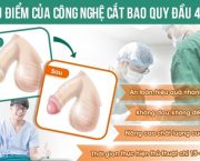 review-cat-bao-quy-dau-tham-my-thuc-hien-o-dau-an-toan-uy-tin